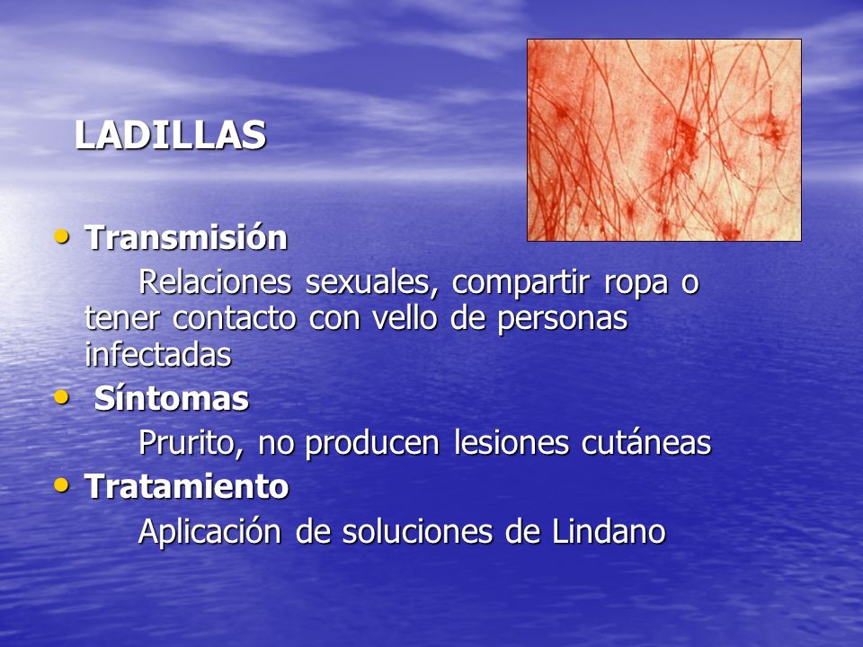 LADILLAS Transmisión. Relaciones sexuales, compartir ropa o tener contacto con vello de personas infectadas.