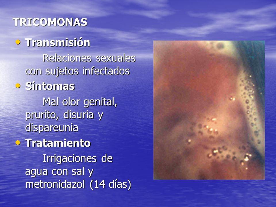TRICOMONAS Transmisión. Relaciones sexuales con sujetos infectados. Síntomas. Mal olor genital, prurito, disuria y dispareunia.