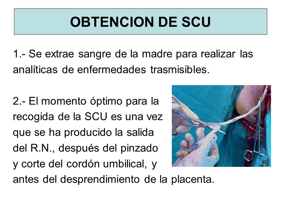 OBTENCION DE SCU 1.- Se extrae sangre de la madre para realizar las