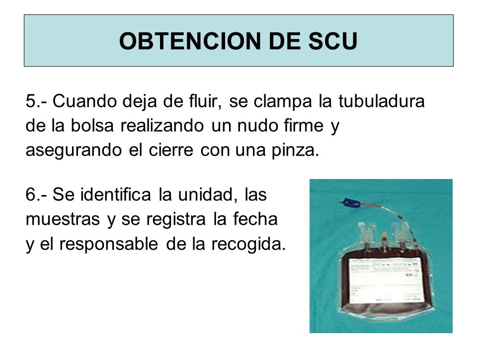 OBTENCION DE SCU 5.- Cuando deja de fluir, se clampa la tubuladura