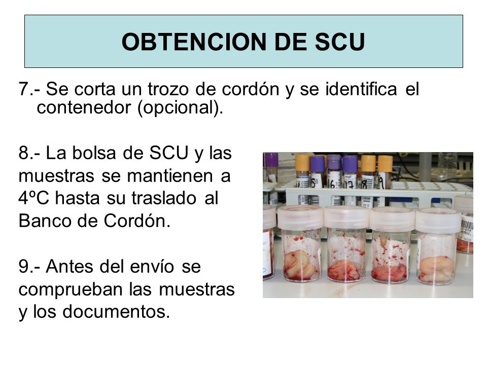 OBTENCION DE SCU 7.- Se corta un trozo de cordón y se identifica el contenedor (opcional). 8.- La bolsa de SCU y las.