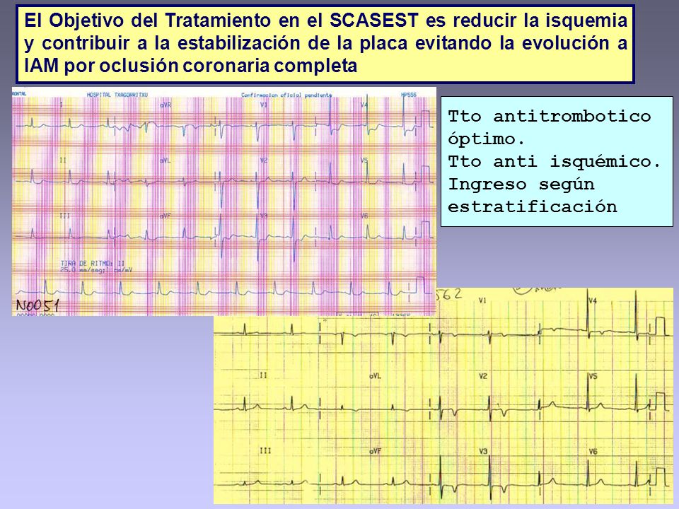 El Objetivo del Tratamiento en el SCASEST es reducir la isquemia y contribuir a la estabilización de la placa evitando la evolución a IAM por oclusión coronaria completa