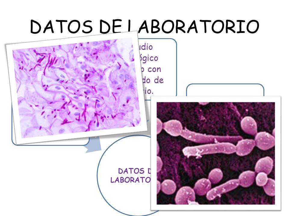 DATOS DE LABORATORIO DATOS DE LABORATORIO. Tincion de Gram, PAS o azul de metileno. Estudio micológico directo con hidróxido de potasio.