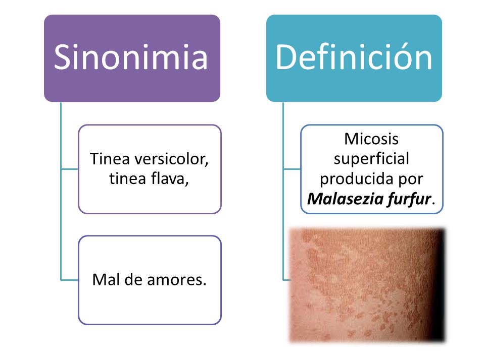 Sinonimia Tinea versicolor, tinea flava, Mal de amores.