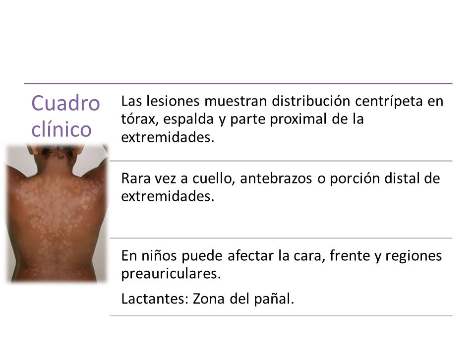 Cuadro clínico Las lesiones muestran distribución centrípeta en tórax, espalda y parte proximal de la extremidades.