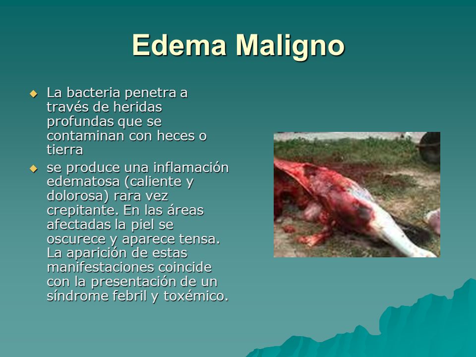 Edema Maligno La bacteria penetra a través de heridas profundas que se contaminan con heces o tierra.