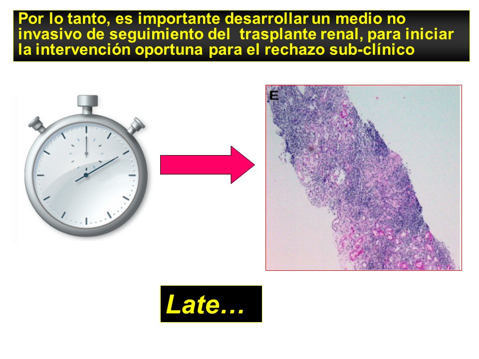 Por lo tanto, es importante desarrollar un medio no invasivo de seguimiento del trasplante renal, para iniciar la intervención oportuna para el rechazo sub-clínico