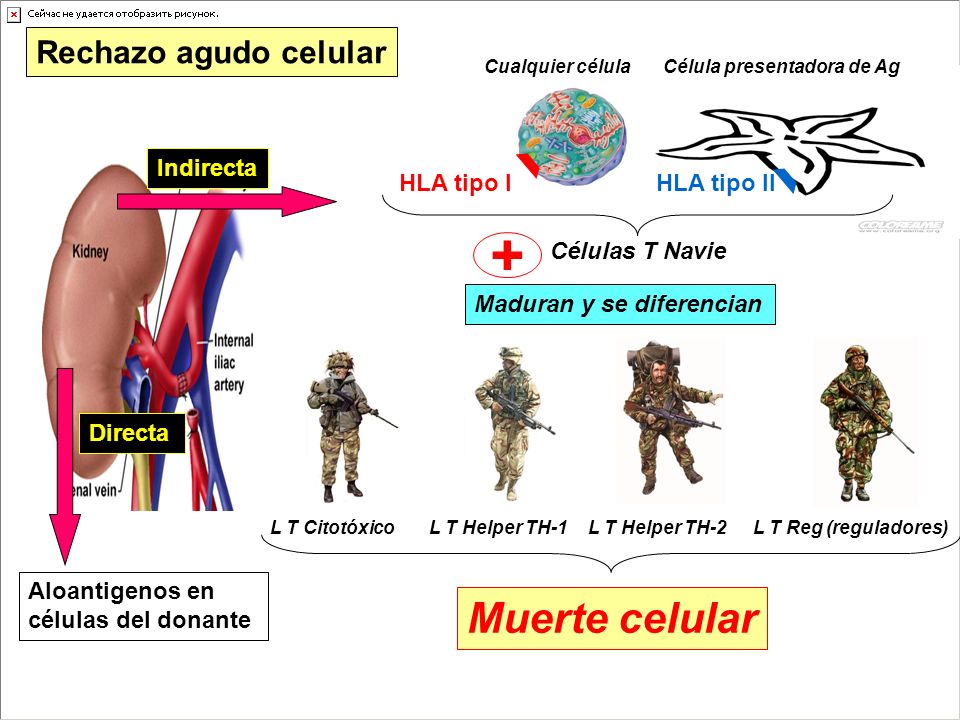 + Muerte celular Rechazo agudo celular Indirecta HLA tipo I