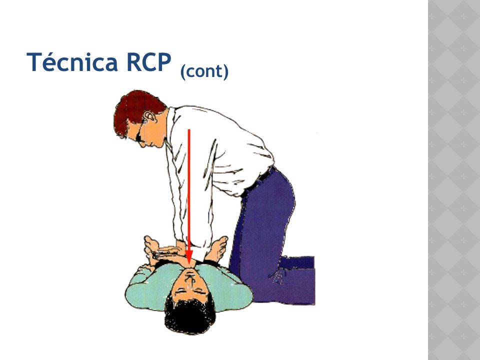 Técnica RCP (cont)