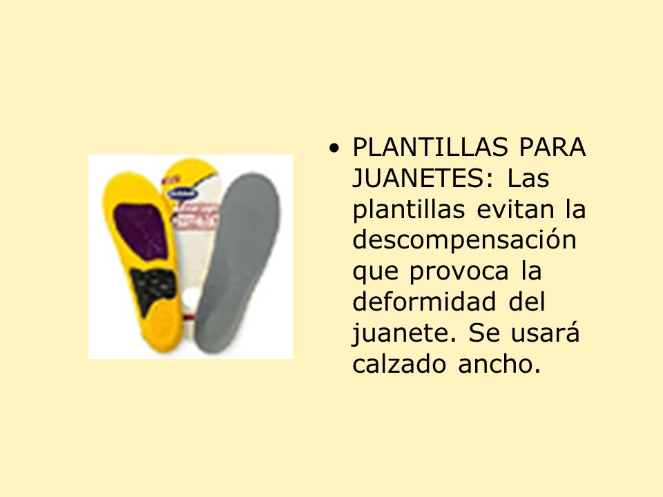 PLANTILLAS PARA JUANETES: Las plantillas evitan la descompensación que provoca la deformidad del juanete.