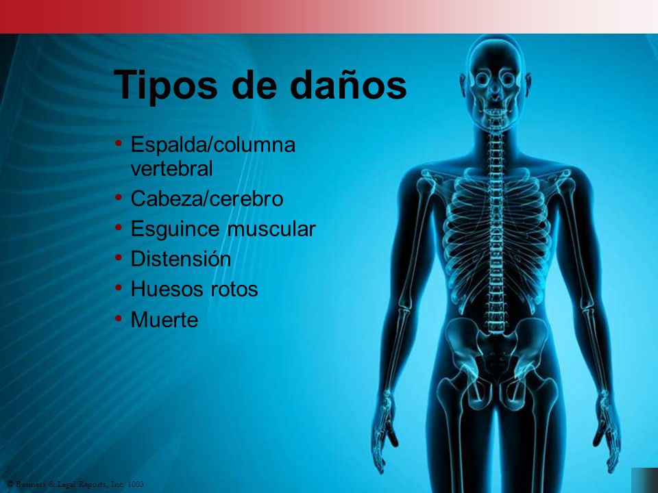 Tipos de daños Espalda/columna vertebral Cabeza/cerebro