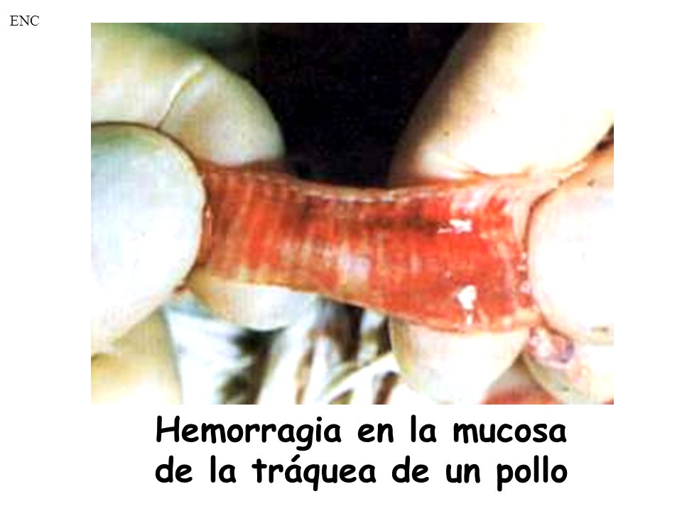 Hemorragia en la mucosa de la tráquea de un pollo