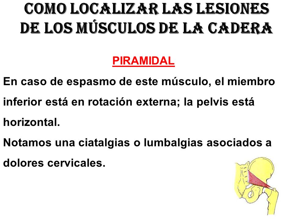 Como localizar las lesiones de los músculos de la cadera
