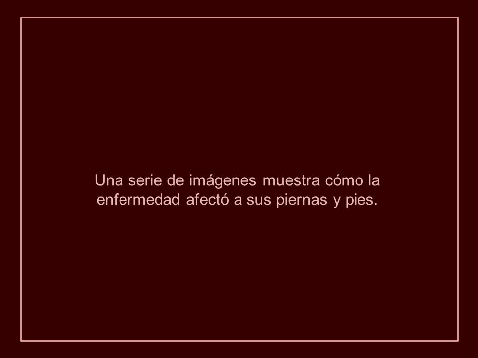 Una serie de imágenes muestra cómo la enfermedad afectó a sus piernas y pies.