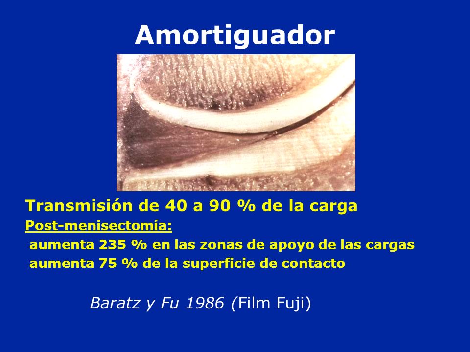 Amortiguador Transmisión de 40 a 90 % de la carga