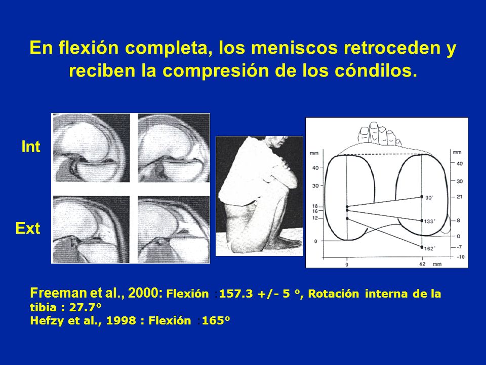 En flexión completa, los meniscos retroceden y reciben la compresión de los cóndilos.