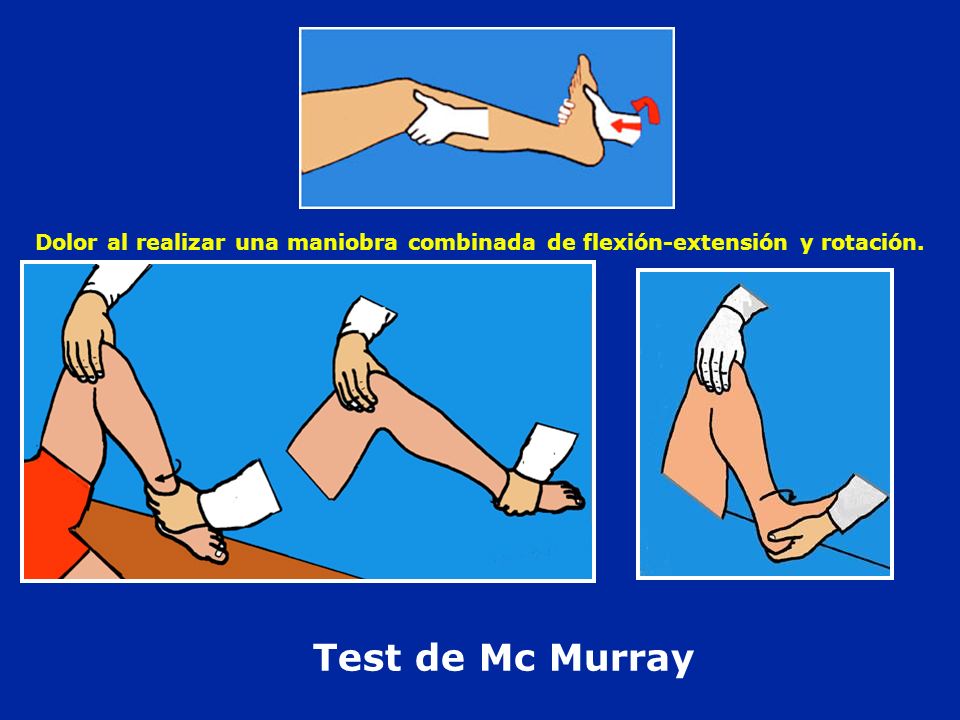 Dolor al realizar una maniobra combinada de flexión-extensión y rotación.