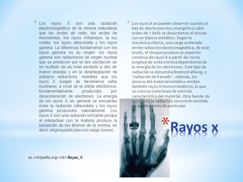 Los rayos X son una radiación electromagnética de la misma naturaleza que las ondas de radio, las ondas de microondas, los rayos infrarrojos, la luz visible, los rayos ultravioleta y los rayos gamma. La diferencia fundamental con los rayos gamma es su origen: los rayos gamma son radiaciones de origen nuclear que se producen por la des excitación de un nucleón de un nivel excitado a otro de menor energía y en la desintegración de isótopos radiactivos, mientras que los rayos X surgen de fenómenos extra nucleares, a nivel de la órbita electrónica, fundamentalmente producidos por desaceleración de electrones. La energía de los rayos X en general se encuentra entre la radiación ultravioleta y los rayos gamma producidos naturalmente. Los rayos X son una radiación ionizante porque al interactuar con la materia produce la ionización de los átomos de la misma, es decir, origina partículas con carga (iones).