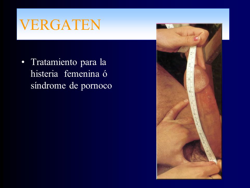 VERGATEN Tratamiento para la histeria femenina ó síndrome de pornoco