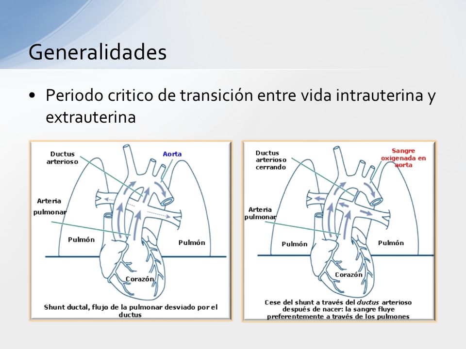 Generalidades Periodo critico de transición entre vida intrauterina y extrauterina