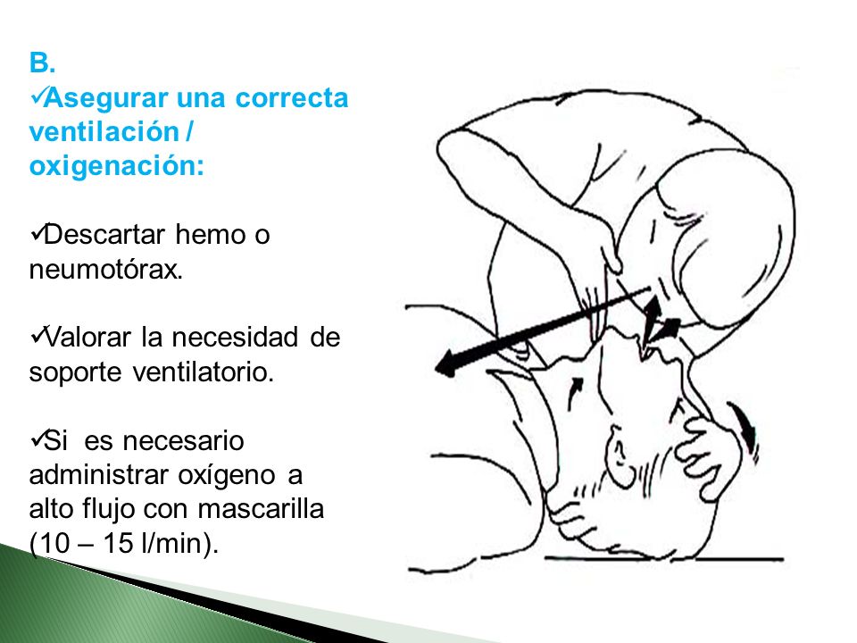 B. Asegurar una correcta ventilación / oxigenación: Descartar hemo o neumotórax. Valorar la necesidad de soporte ventilatorio.
