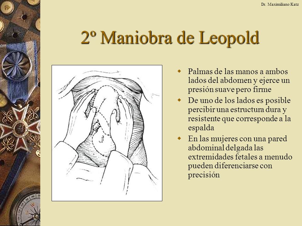 Dr. Maximiliano Katz 2º Maniobra de Leopold. Palmas de las manos a ambos lados del abdomen y ejerce un presión suave pero firme.