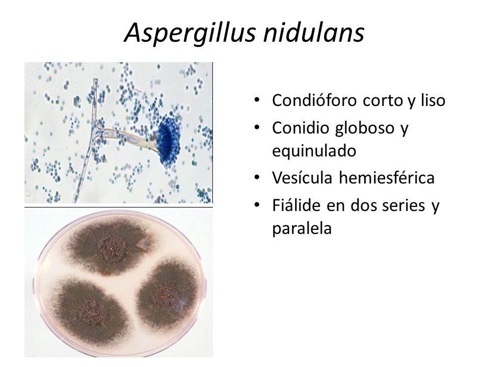 Aspergillus nidulans Condióforo corto y liso