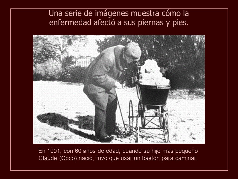 Una serie de imágenes muestra cómo la enfermedad afectó a sus piernas y pies.