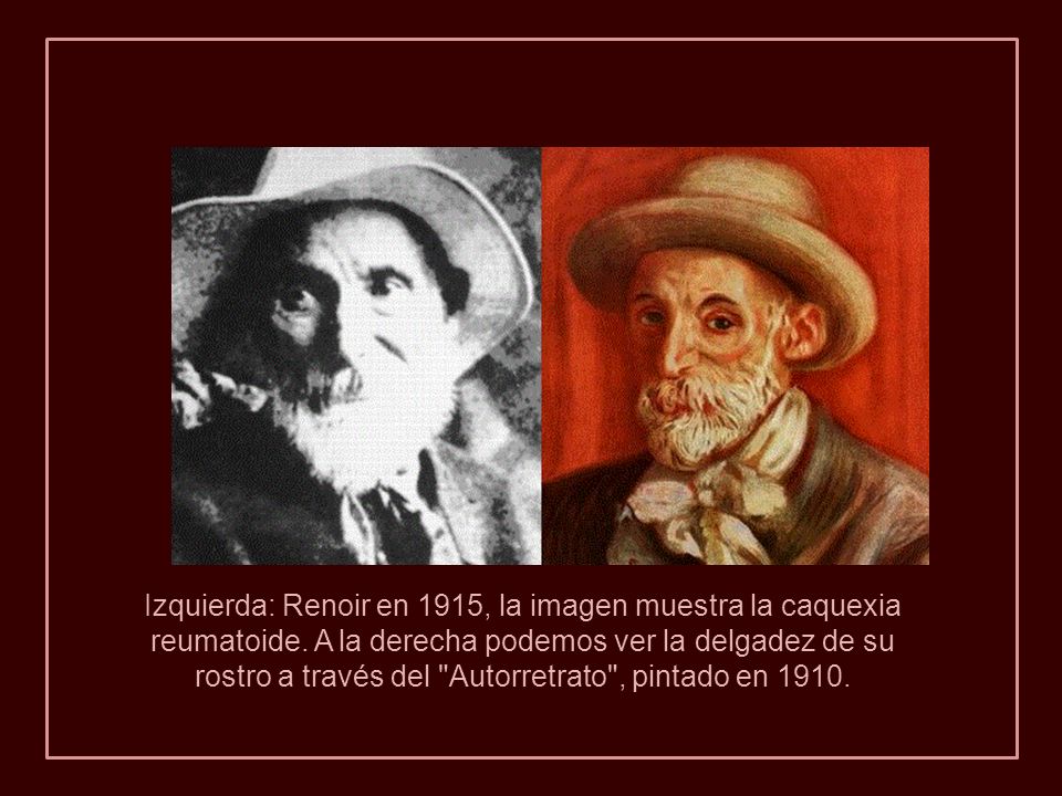 Izquierda: Renoir en 1915, la imagen muestra la caquexia reumatoide