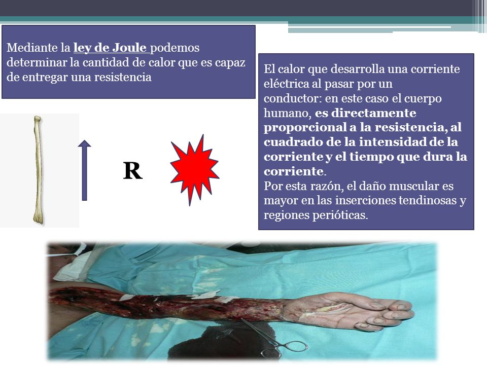 Mediante la ley de Joule podemos determinar la cantidad de calor que es capaz de entregar una resistencia