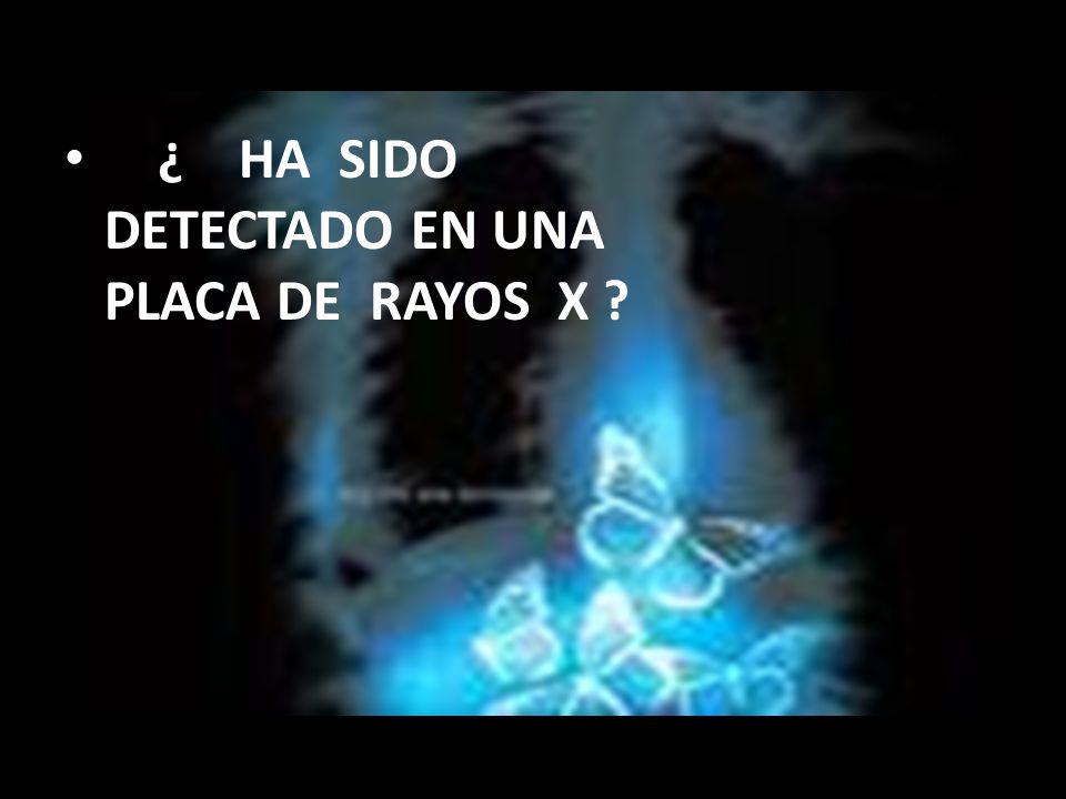¿ HA SIDO DETECTADO EN UNA PLACA DE RAYOS X