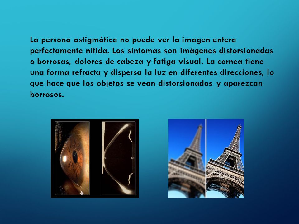 La persona astigmática no puede ver la imagen entera perfectamente nítida.