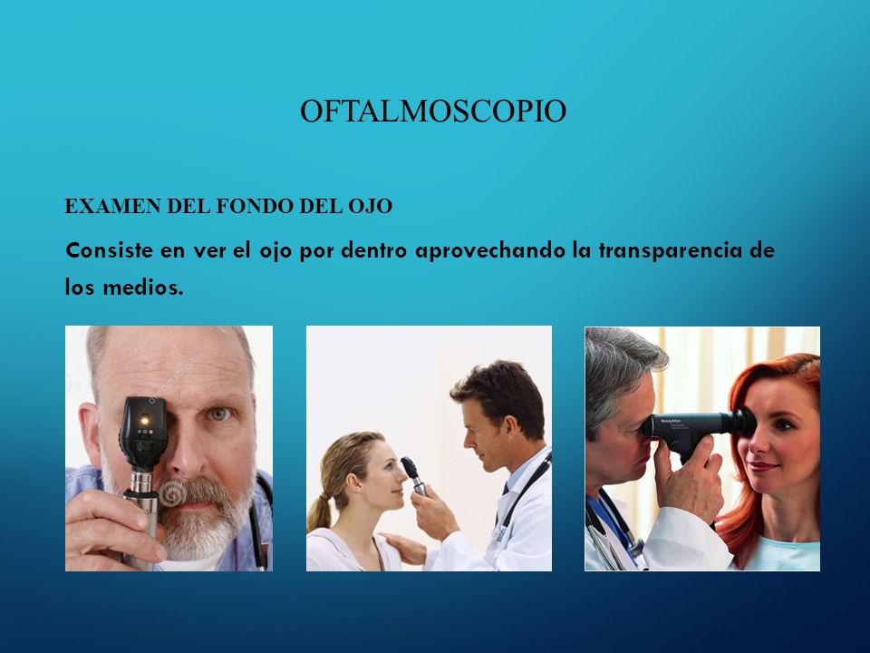 OFTALMOSCOPIO EXAMEN DEL FONDO DEL OJO Consiste en ver el ojo por dentro aprovechando la transparencia de los medios.
