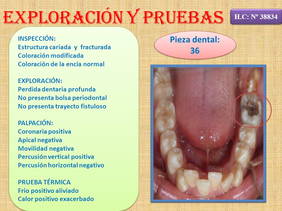 Exploración y Pruebas Pieza dental: 36 H.C: Nº INSPECCIÓN: