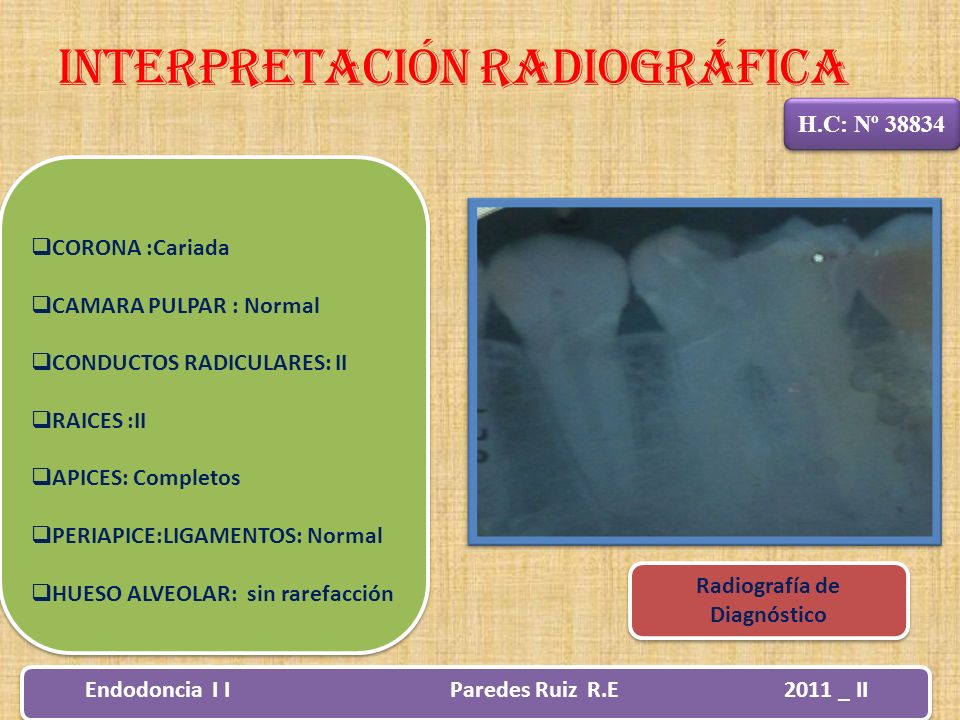 Radiografía de Diagnóstico Endodoncia I I Paredes Ruiz R.E 2011 _ II