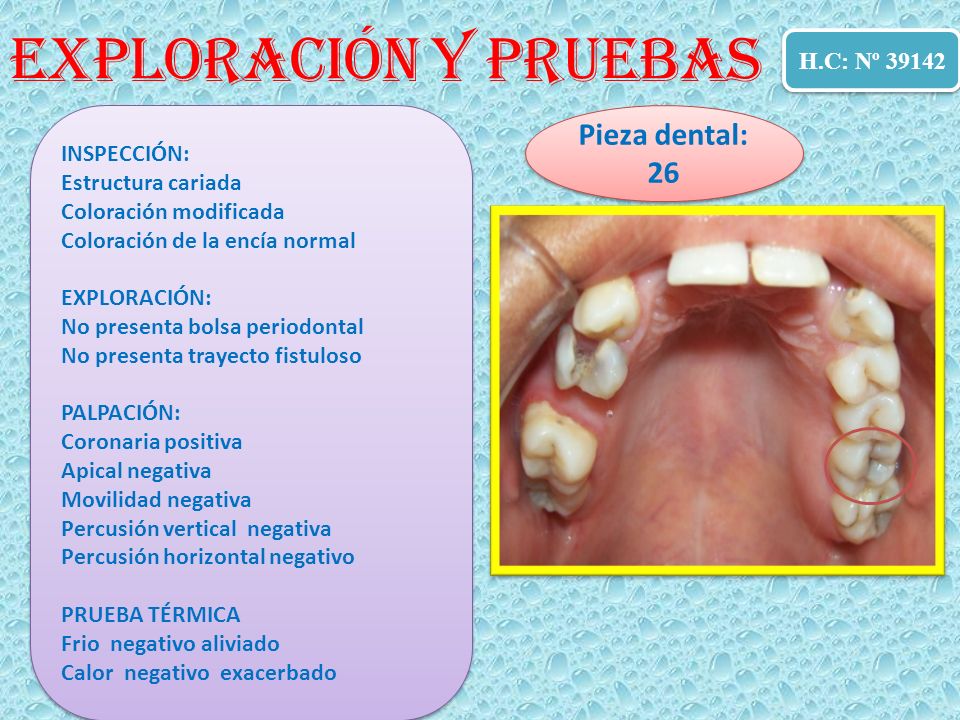 Exploración y Pruebas Pieza dental: 26 H.C: Nº H.C: Nº 38834