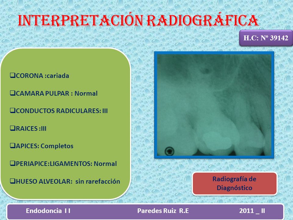 Radiografía de Diagnóstico Endodoncia I I Paredes Ruiz R.E 2011 _ II
