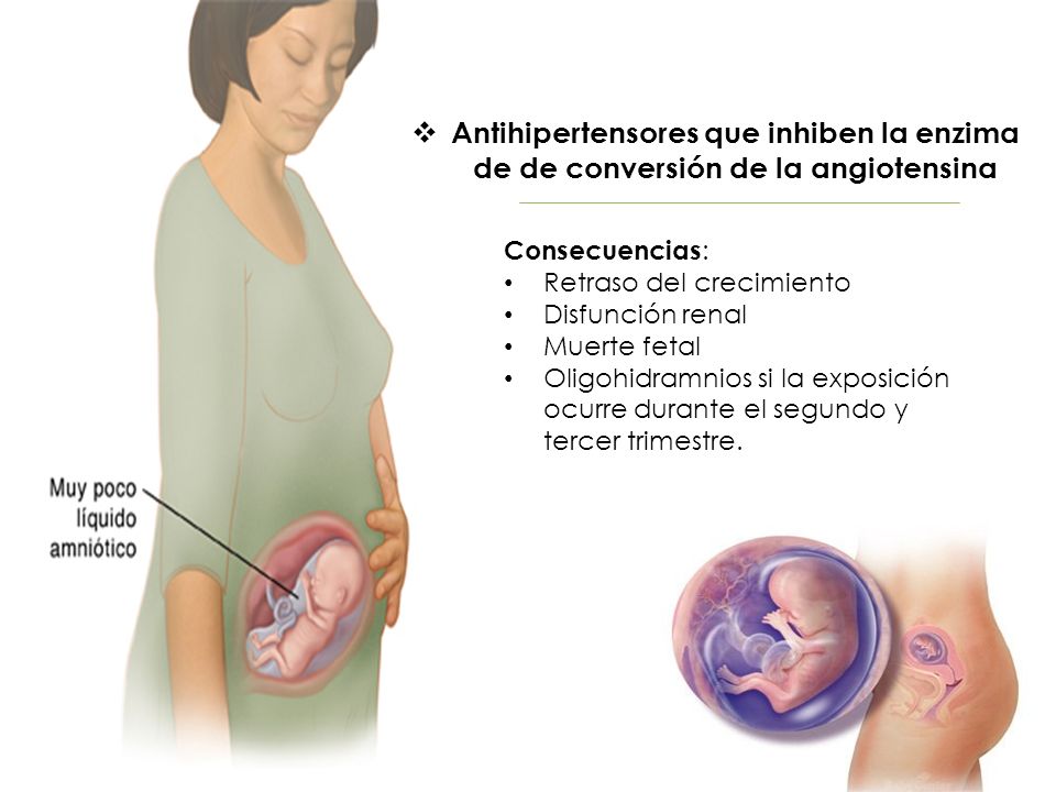 Antihipertensores que inhiben la enzima de de conversión de la angiotensina