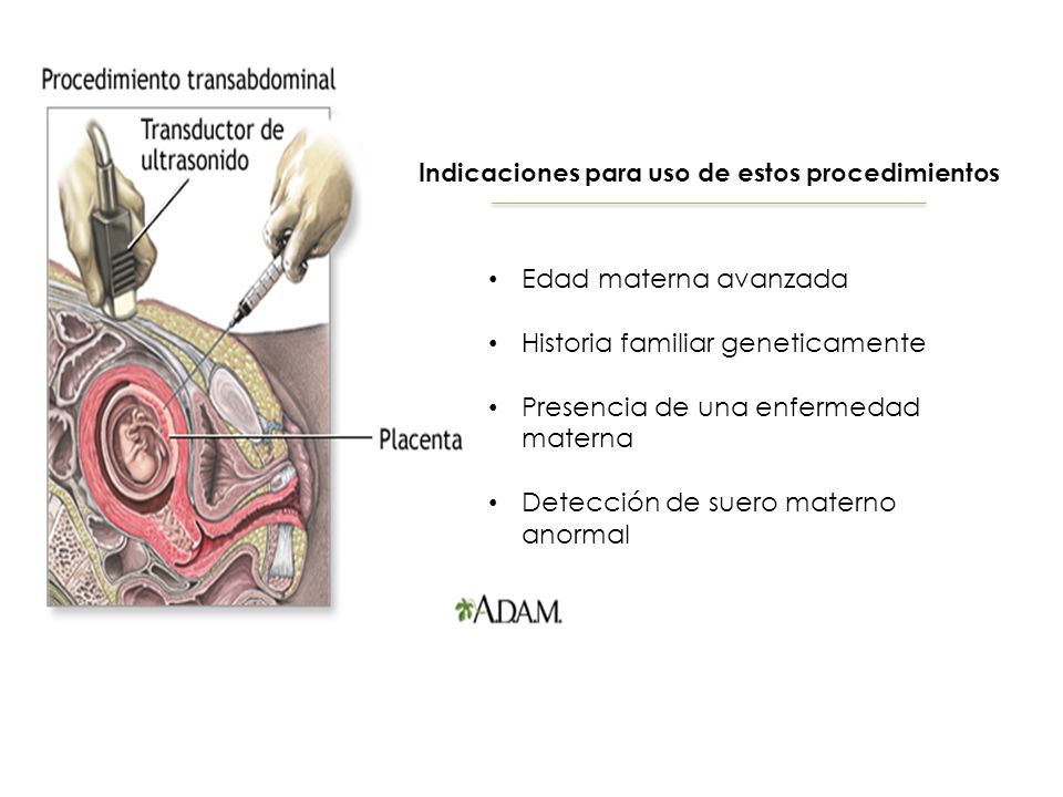 Indicaciones para uso de estos procedimientos