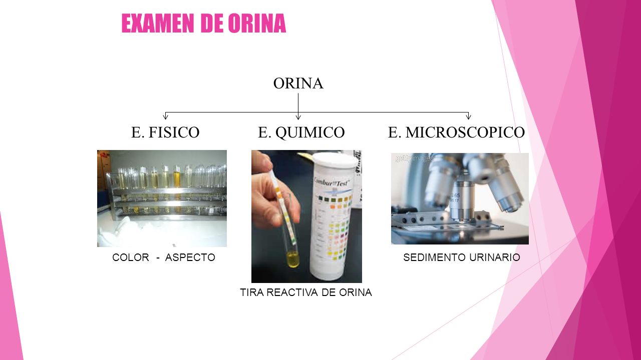 EXAMEN DE ORINA ORINA E. FISICO E. QUIMICO E. MICROSCOPICO