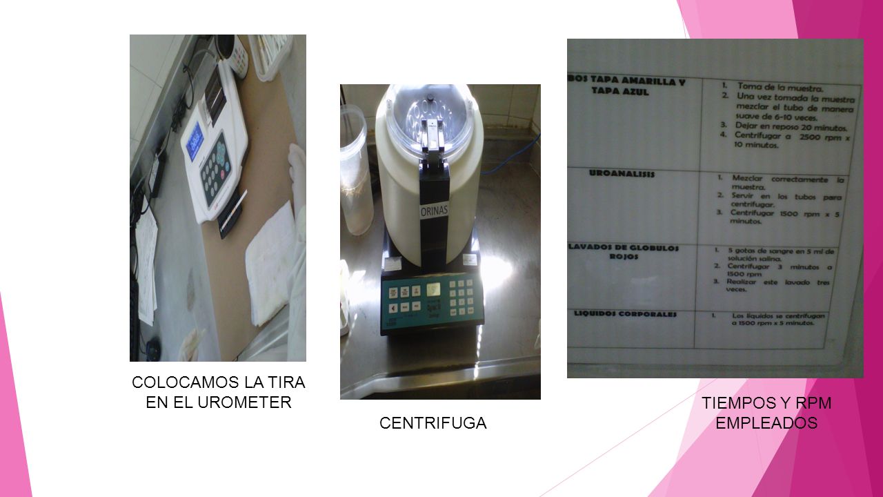 COLOCAMOS LA TIRA EN EL UROMETER TIEMPOS Y RPM EMPLEADOS CENTRIFUGA