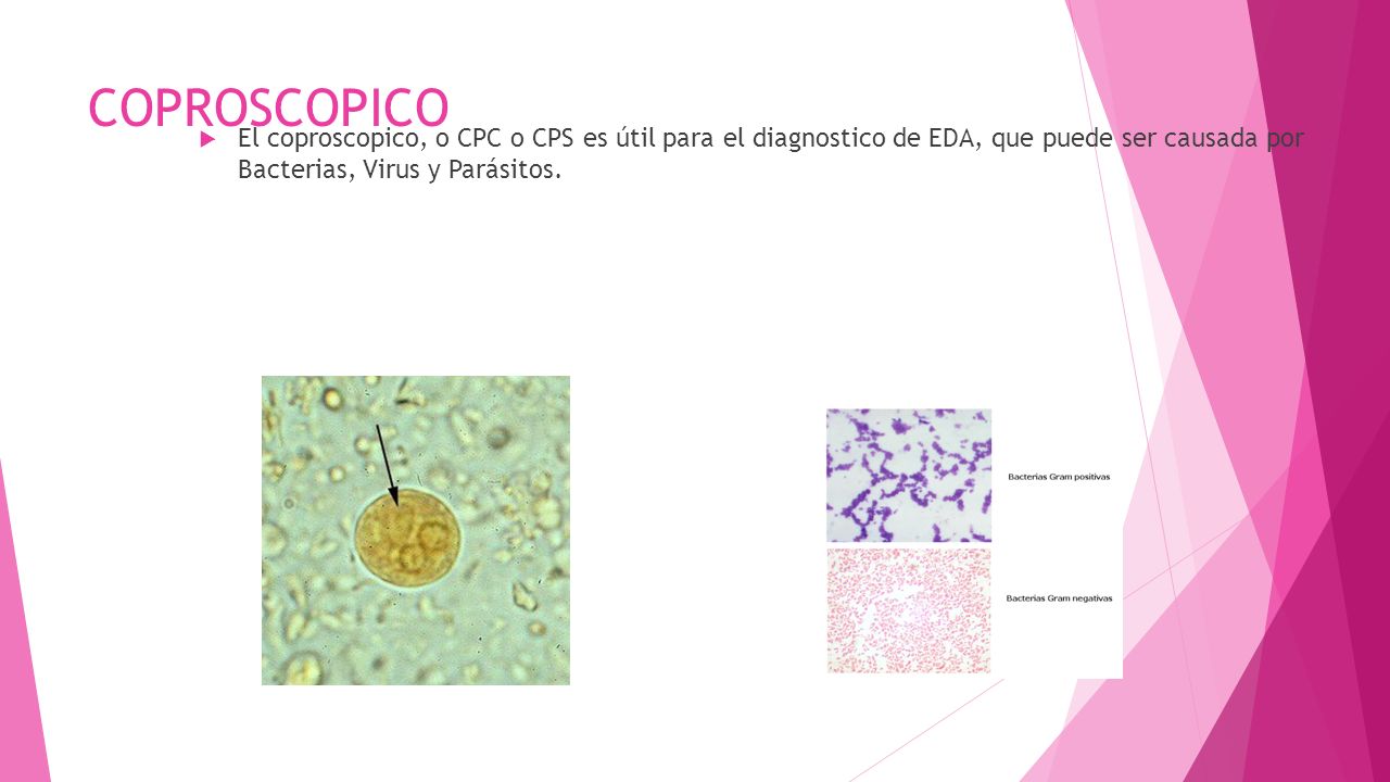 COPROSCOPICO El coproscopico, o CPC o CPS es útil para el diagnostico de EDA, que puede ser causada por Bacterias, Virus y Parásitos.