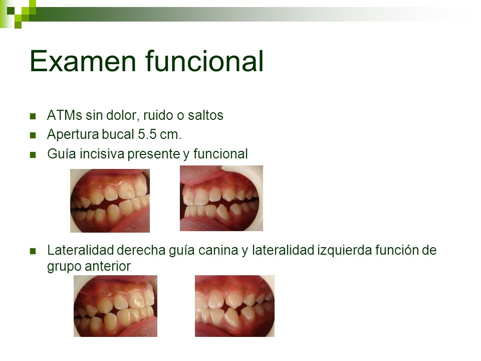 Examen funcional ATMs sin dolor, ruido o saltos Apertura bucal 5.5 cm.