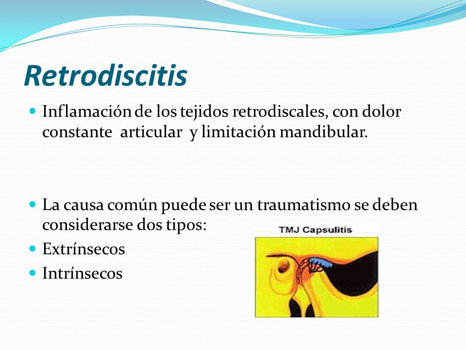 Retrodiscitis Inflamación de los tejidos retrodiscales, con dolor constante articular y limitación mandibular.
