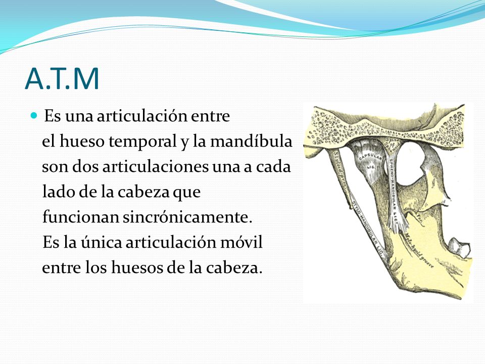 A.T.M Es una articulación entre el hueso temporal y la mandíbula