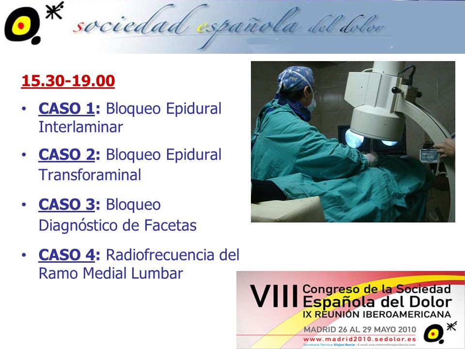 CASO 1: Bloqueo Epidural Interlaminar. CASO 2: Bloqueo Epidural Transforaminal. CASO 3: Bloqueo Diagnóstico de Facetas.