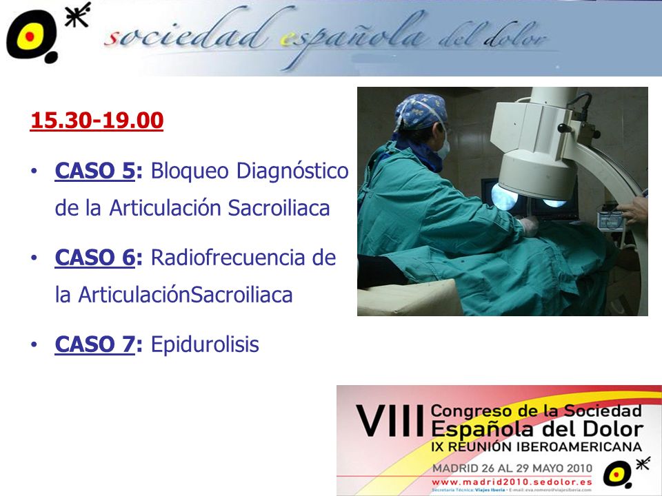 CASO 5: Bloqueo Diagnóstico de la Articulación Sacroiliaca. CASO 6: Radiofrecuencia de la ArticulaciónSacroiliaca.