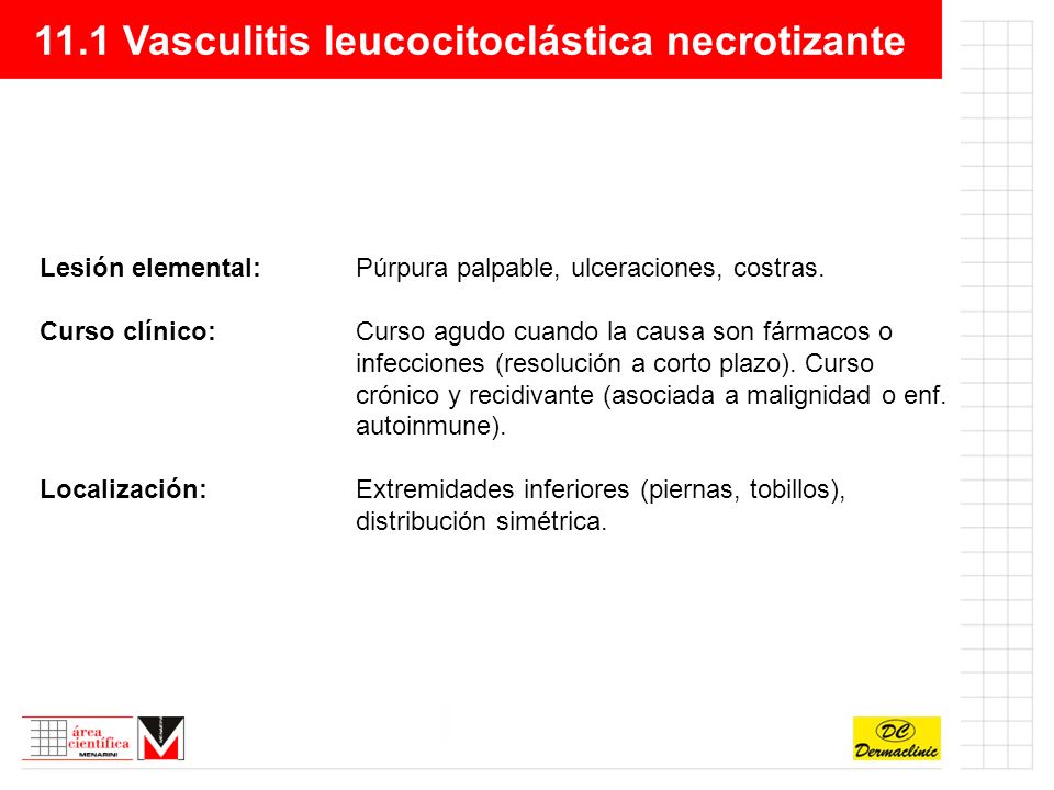 11.1 Vasculitis leucocitoclástica necrotizante