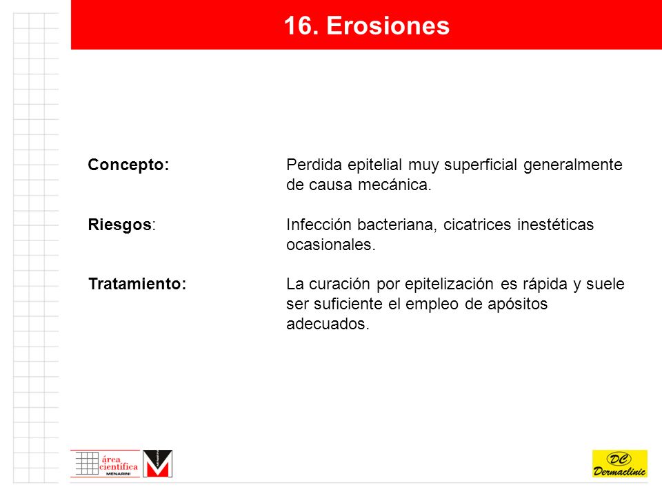 16. Erosiones Concepto: Perdida epitelial muy superficial generalmente de causa mecánica.