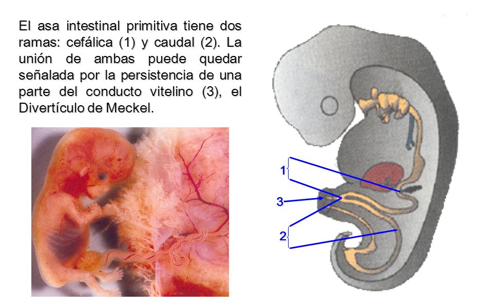 El asa intestinal primitiva tiene dos ramas: cefálica (1) y caudal (2)